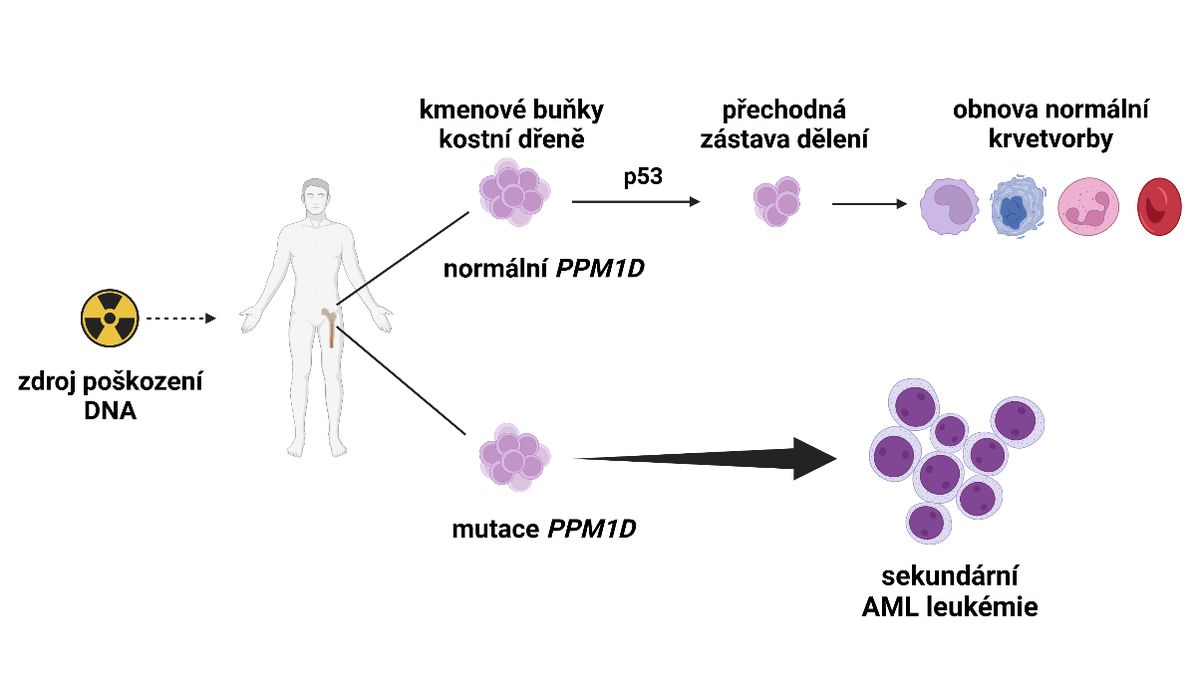 Čeští vědci odhalili nové mutace genu, které se podílejí na rozvoji leukémie